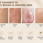 SADOER Anti-Cracking Hand & Foot Cream Shea Butter Repair Moisturizing Nourishing Skin Care