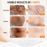 SADOER Dark Knuckle Whitening Cream with Niacinamide & Vitamin C Brightening Care