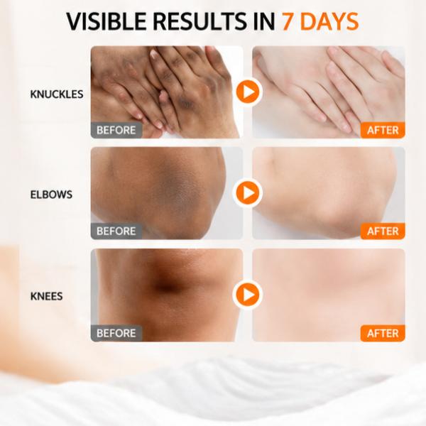 SADOER Dark Knuckle Whitening Cream with Niacinamide & Vitamin C Brightening Care