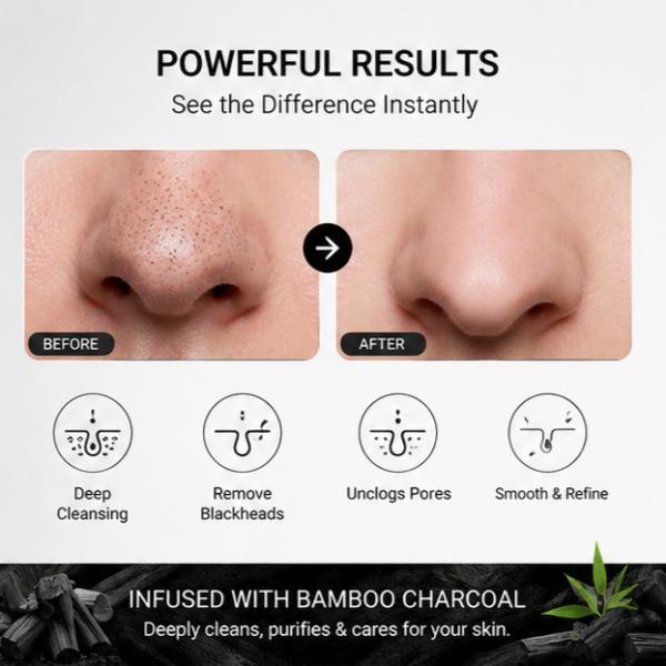 SADOER Bamboo Charcoal Nose Strips 10Pcs Peel Off Blackhead Remover