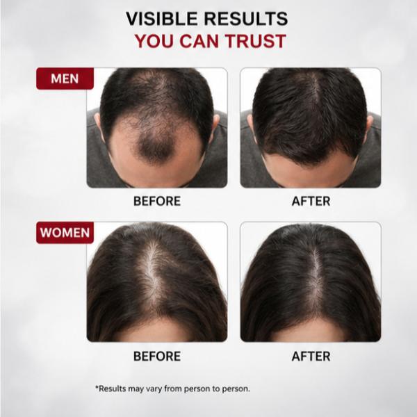 Uptown LA Anti Hair Loss & Regrowth Shampoo Best in Town 170ml
